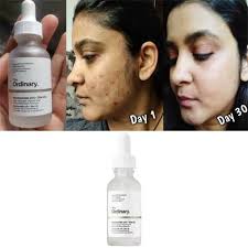 Special offer Niacinamide 10% + Zinc 1% Serum Oil Balance