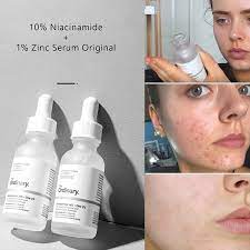 Special offer Niacinamide 10% + Zinc 1% Serum Oil Balance